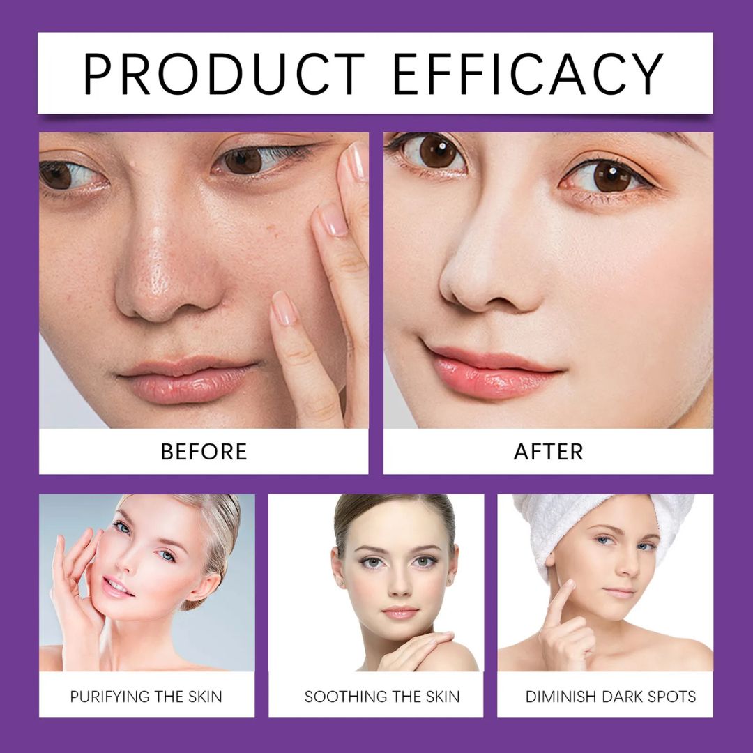AzeClear™ Repair Cream