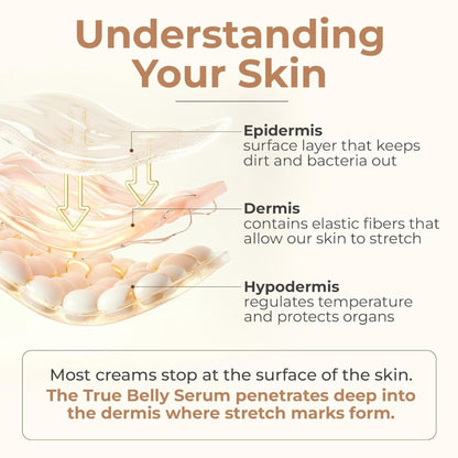 SoftDew™ Moisture Cream