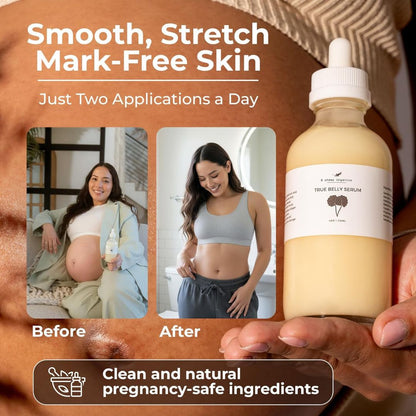 SoftDew™ Moisture Cream